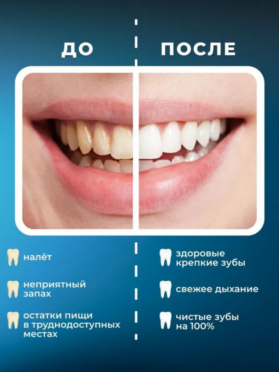 Портативный ирригатор для полости рта MIRU BIP-005, черный купить на кроссвилл