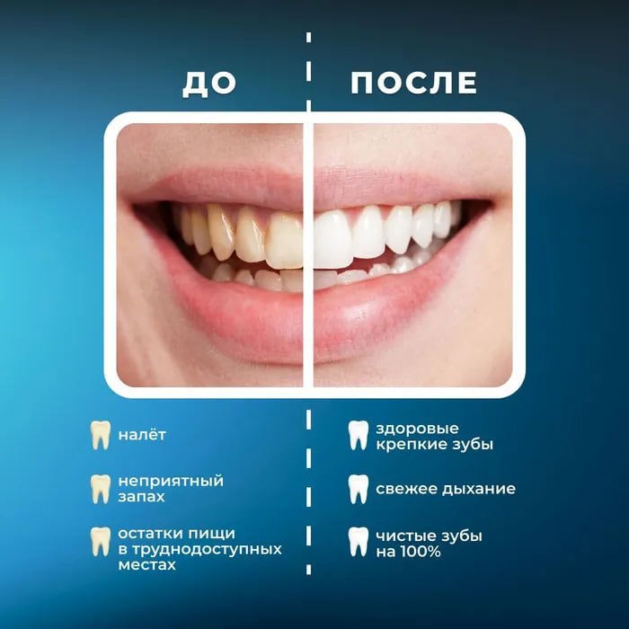 Портативный ирригатор для полости рта MIRU BIP-005, белый купить на CrossVill