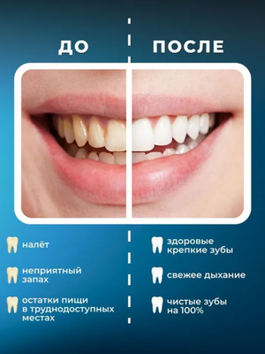 Портативный ирригатор для полости рта MIRU BIP-005, черный купить на кроссвилл