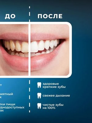 Портативный ирригатор для полости рта MIRU BIP-005, белый купить на CrossVill
